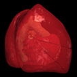 7.png 3D Model of Transposition of the Great Arteries Open Duct