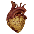 Obese_002.png Anatomical model of obese heart