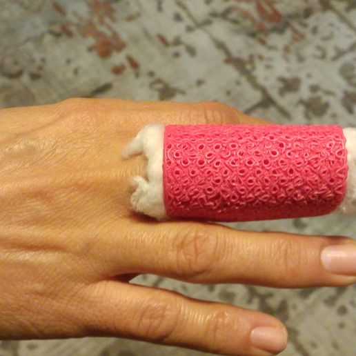 Free STL file finger splints・3D printer design to download・Cults