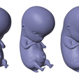 6_Weeks_NM.png 6 Weeks Human embryonic (baby stages)