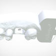 Screenshot_5.png Digital Quadrant Model with 3Shape Articulator Interfaces