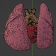 33.png 3D Model of Transposition of the Great Arteries Open Duct