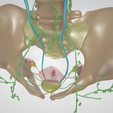 CERVICAL-CANCER-2.png 3D CÁNCER DE CUELLO UTERINO CON ÚTERO, GANGLIOS LINFÁTICOS, SISTEMA URINARIO, VÉRTEBRAS Y PELVIS