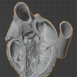5.png 3D Model of Heart (apical 3 chamber plane)