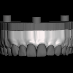 Captura de Pantalla 2020-04-02 a la(s) 19.13.34.png Dental Model with detachable teeth