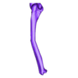 Both%20bone%20malunion%20sag%2020%20degrees.stl Entire collection of simulated forarm angulated malunions