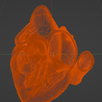 16.png 3D Model of the Heart with Tetralogy of Fallot, parasternal long axis