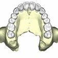 20.jpg maxilar con dientes