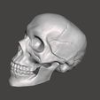 Cracked-Skull-Pic-2.jpg Cracked Skull
