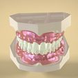 digital-full-dentures-3d-model-stl.png2.jpg STL file Digital Full Dentures・3D printer model to download