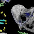 pelvis-types-hip-bone-labelled-detailed-3d-model-371abd885e.jpg Pelvis types hip bone labelled detailed 3D model