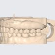 MeditLink_Image_Data_-1.jpg MODELO PEDAGÓGICO DR CAPARACHINI STRAUMANN - NEODENT (INCLUINDO ANÁLOGOS)