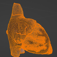 19.png 3D Model of Heart wirh Atrioventricular Septal Defect, 4 chamber view