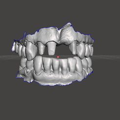 brogio4front.jpg Dental model case Exocad cad practice #1