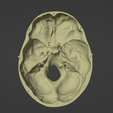 15.png 3D Model of Skull and Brain with Brain Stem