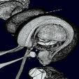 screenshot166.jpg Central nervous system cortex limbic basal ganglia stem cerebel 3D model