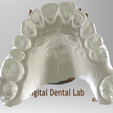 Screenshot_3.png Digital Surgical Guide (Planned Implant)