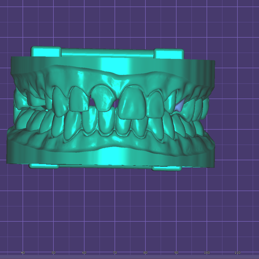 Screenshot_4.png 带功能关节器接口的数字切面模型