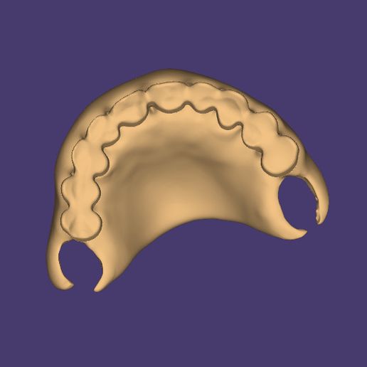 Clipboard-2024-06-11-20-47-40.jpg DENTURE PARTIELLE FLEXIBLE NUMERIQUE (base supérieure + dents artificielles)