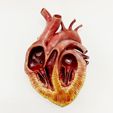 FullSizeRender-3.jpg Anatomical human obese heart in cross section