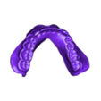 789513050_20230927_1549_Tech_01_0_Monoblock_Print.stl DIGITAL TOTAL REMOVABLE DENTURES - 6 stl files (upper jaw, lower jaw, artificial teeth for upper and lower jaw, 2x monoblock)