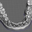 WhatsApp-Image-2024-04-14-at-11.58.51.jpeg Digital dental model for practice