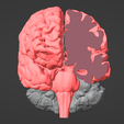 2.png 3D Model of Brain - section