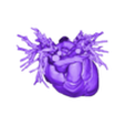 STL.stl 3D Model of Human Heart with Double Aortic Arch (DAA) - generated from real patient