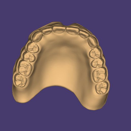 DIGITAL TOTAL REMOVABLE DENTURES - 6 stl-Dateien (Oberkiefer, Unterkiefer,  knstliche Zhne fr Ober- und Unterkiefer, 2x Monoblock) STL Datei fr  3D-DruckCults