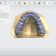 Screenshot_17.png Digital Full Coverage Occlusal Splint with Canine Guidance