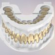 8.jpg 3D Dental Jaws Replica with Detachable Teeth