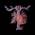 Heart-vascular-reconstruction1.jpg Heart Vascular 3D Reconstruction