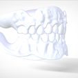 Screenshot_19.png Digital Try-in Full Dentures for Injection Molding