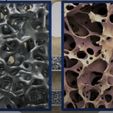 trabecular-shape.jpg Cage XLIF (Extreme Lateral Interbody Fusion )