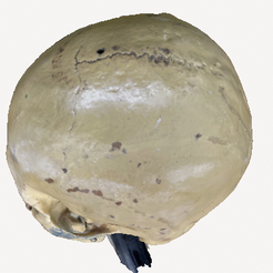skulltopside.png Free STL file Tragic Skull - A 3D Model of Mortal Impact - Too BE or Not...・3D printer model to download
