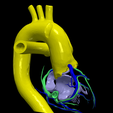9.png 3D Model of Common Arterial Trunk Truncus Arteriosus