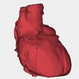 5.jpg congenital heart disease classification ( CHD )