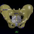 pelvis-fracture-classifications-3d-model-blend-26.jpg Pelvis fracture classifications 3D model