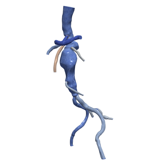 Download OBJ file 3d model of aorta and femoral arteries • Object to 3D ...