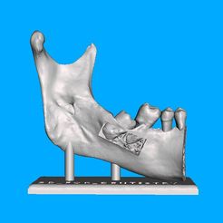 Captura-de-tela-2023-08-28-130938.jpg STL file Modelo terceiro molar・Model to download and 3D print