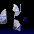lung-pulmonary-segment-anatomy-3d-model-blend-1.jpg Lung Pulmonary segment anatomy 3D model