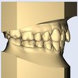 2.jpg dental model nice