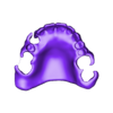 789513050_20241126_1405_Tech_01__A3_HaD_flex_1_Monoblock_Print.stl DIGITAL FLEXIBLE PARTIAL DENTURES upper + lower (3D models !!!) - 12 stl files for download
