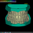 Captura-de-pantalla-47.png UPPER & LOWER TEETH