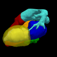 3.png 3D Heart Model - generated from real patient