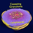 caseating-granuolma-tuberculosis-labelled-3d-model-blend.jpg Caseating granuolma tuberculosis labelled 3D model