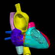 6.png Modèle 3D de la valve aortique bicuspide (BAV)