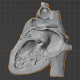 5.png 3D Model of Heart (apical 2 chamber plane)