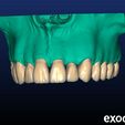 photo_6_2023-09-16_16-48-19.jpg Phantom dental model for dental technicians