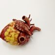 IMG_9327.jpg Anatomical model of obese heart
